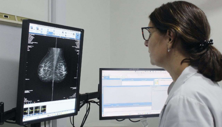La Provincia cambia la edad recomendada para realizar la primera mamografía