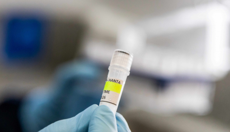 Hantavirus: Argentina asiste a países de Europa y África con insumos de diagnóstico
