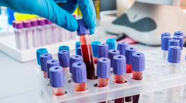 Bioquímicos bonaerenses comenzarán a cobrar un bono compensatorio a afiliados de prepagas