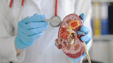 Día Mundial del Riñón: concientización y prevención para proteger la salud renal