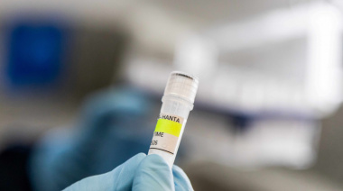 Hantavirus: Argentina asiste a países de Europa y África con insumos de diagnóstico